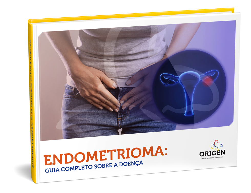 E-book | Endometrioma: guia completo sobre a doença 