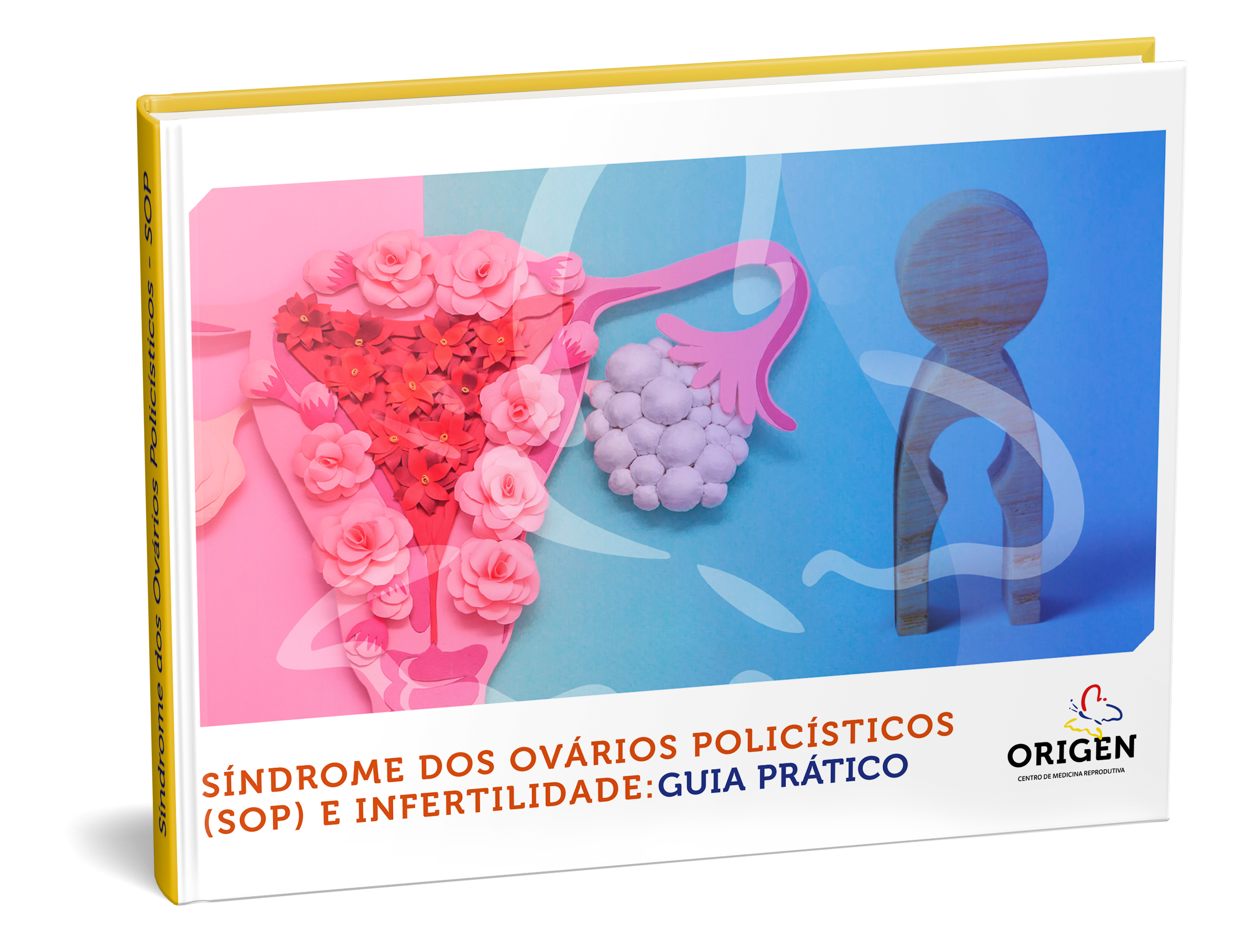 E-book | Síndrome dos ovários policísticos (SOP) e infertilidade: guia prático